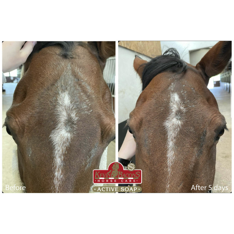 Savon Anti Démangeaison Kevin Bacon's Active Soap Avant/après